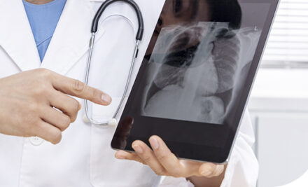 만성 폐쇄성 폐질환(COPD) 환자 산소 치료법