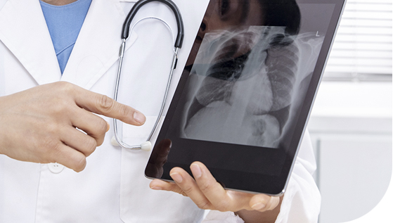 만성 폐쇄성 폐질환(COPD) 환자 산소 치료법